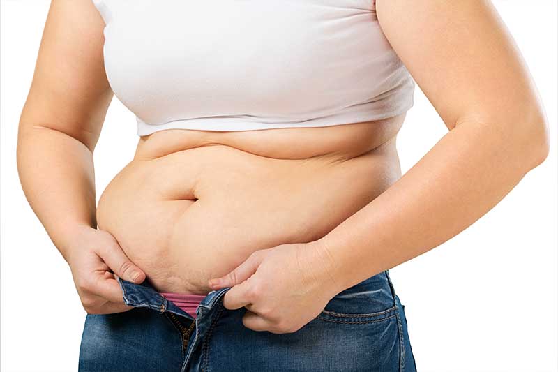 Bariatric Surgery in Antalya